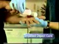 clinical emergencies 17 Impaled objects