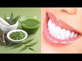 This Powerful Homemade Toothpaste Helps Cavities Gum Disease and Whitens Teeth Naturally!