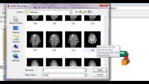 Final Year Projects | Brain Tumor Classification Using Wavelet and Texture Based Neural Network