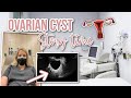 My Ovarian Cyst Story... Part 1