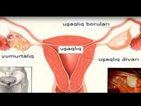 Video: Niyə Menstruasiya Ilə Kilsəyə Gedə Bilmirsən?
