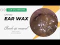 Mr chenda ear wax removal by a health care provider the pain 182022status