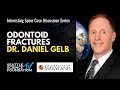 Interesting Spine Case Discussion Series: Odontoid Fractures - Dr. Daniel Gleb