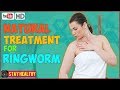 11 Natural Treatment for Ringworm