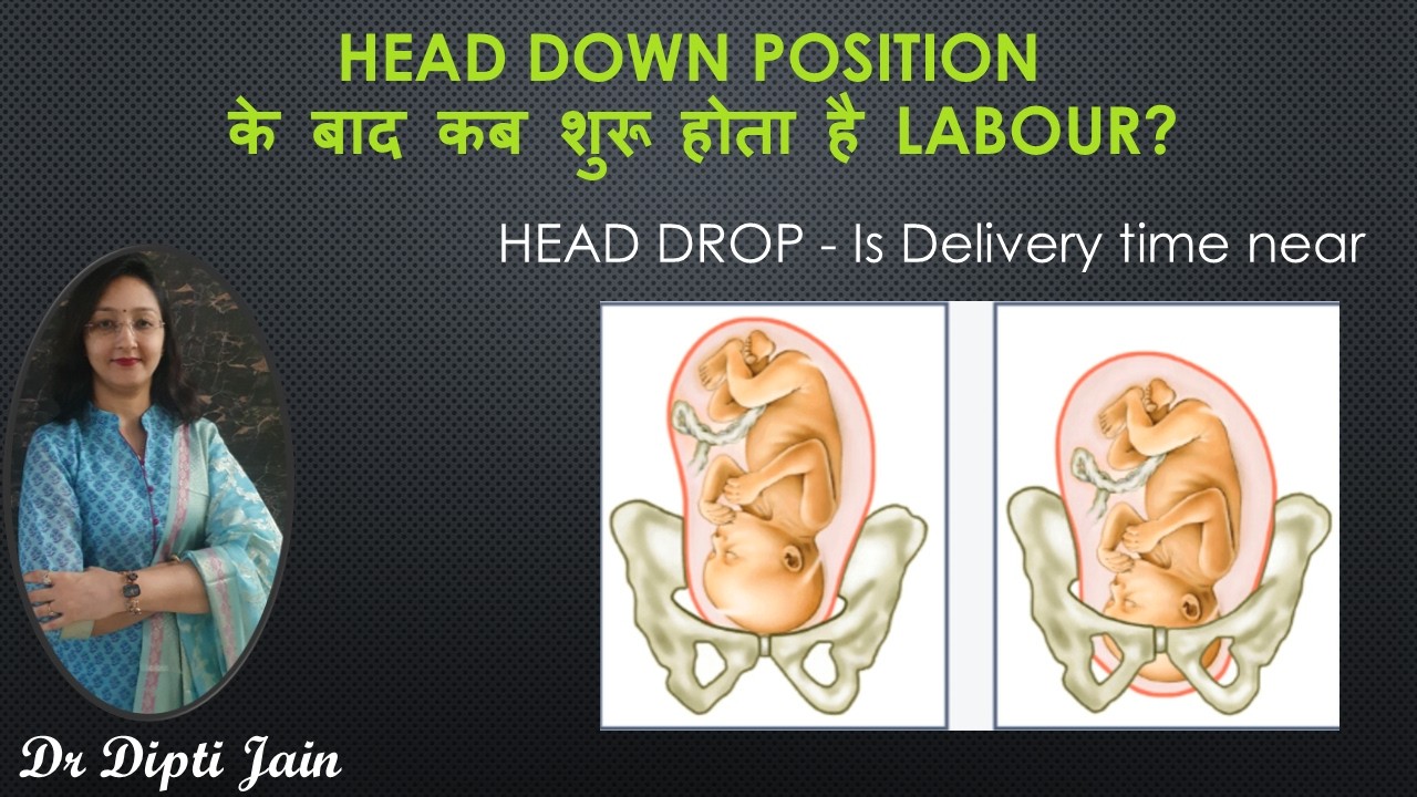 Head Down Position के बाद कब शुरू होता है Labour? डॉक्टर से जानिए” Head Drop - Is Delivery time near