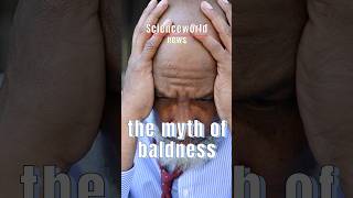 the myth of baldness