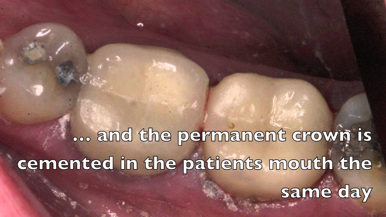 A Patient S Experience With High Tech Dentistry Patient Experience Dentistry Patient