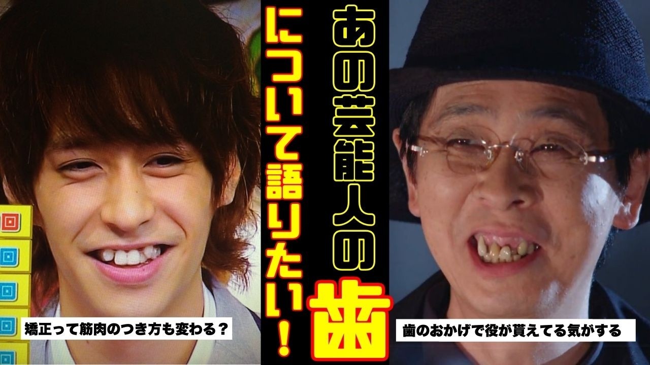 【検証】衝撃！気になる芸能人の「歯」【ガルちゃん芸能人】