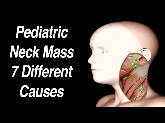 Pediatric Neck Mass: 7 Different Causes Based on Location - YouTube