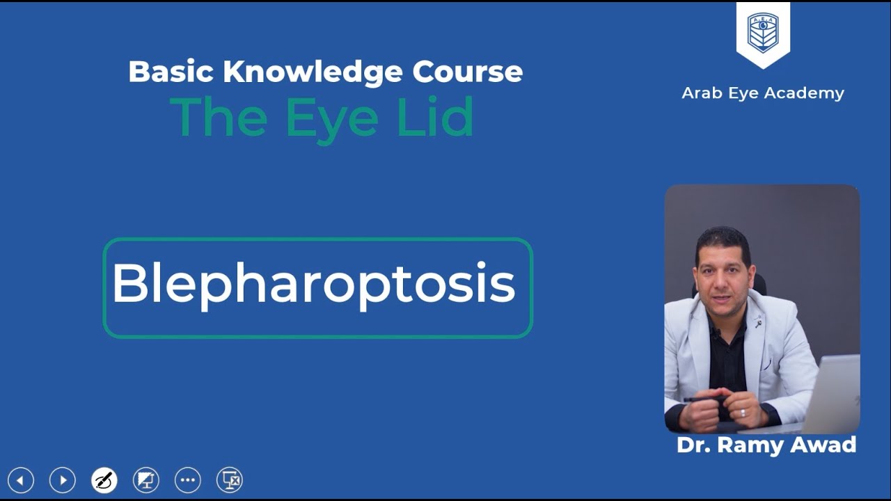 Lecture 3: Eyelid and eyelid diseases (part 3), Blepharoptosis