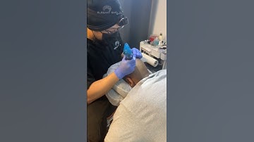 Session 2 #scalpmicropigmentation #buffalony #hairlosstreatment