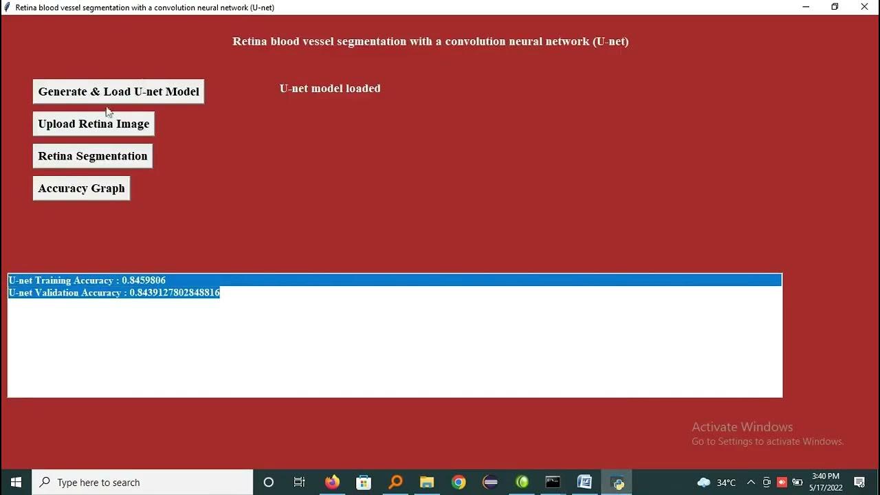 Retina blood vessel segmentation with a convolution neural network U ...
