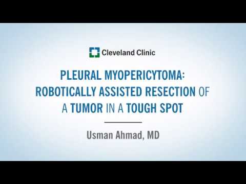 healthcare informatics Tumor in a Tough Spot: Robotically Assisted Resection of a Pleural Myopericytoma