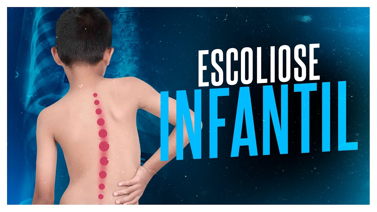 Criança Com Escoliose Durante a Fisioterapia Foto de Stock