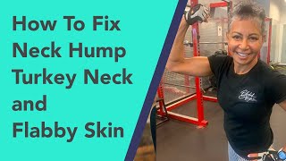 How To Fix Neck Hump, Turkey Neck and Flabby Skin by Modern Aging - Holistic Health & Wellness After 50 723 views 1 year ago 29 minutes