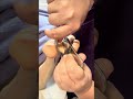 Foot Massage to Activate Weak Foot Muscle by Guasha and Metal Stick