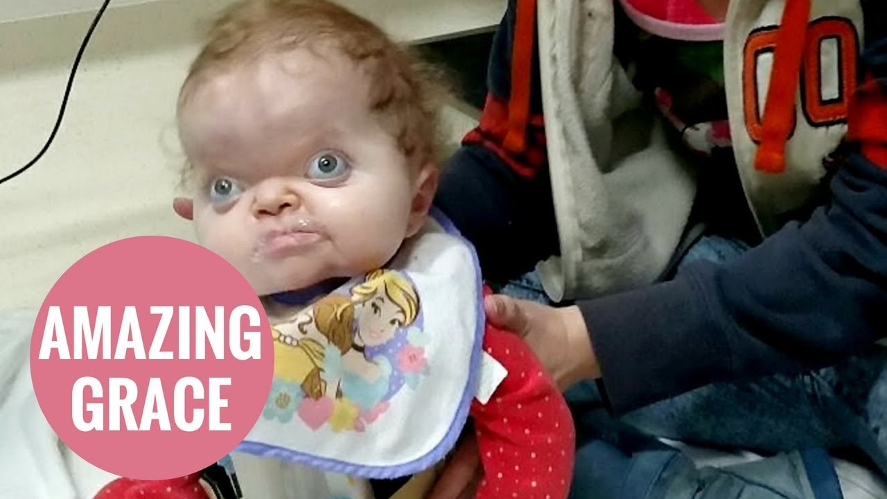 girls like you Toddler with rare condition defies doctors to sit up for the first time
