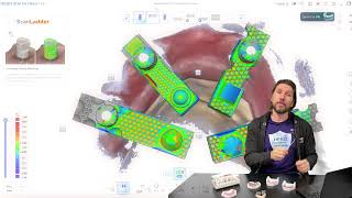 Full Photogrammetry vs Traditional All on X Scan Bodies vs Scan Ladder News