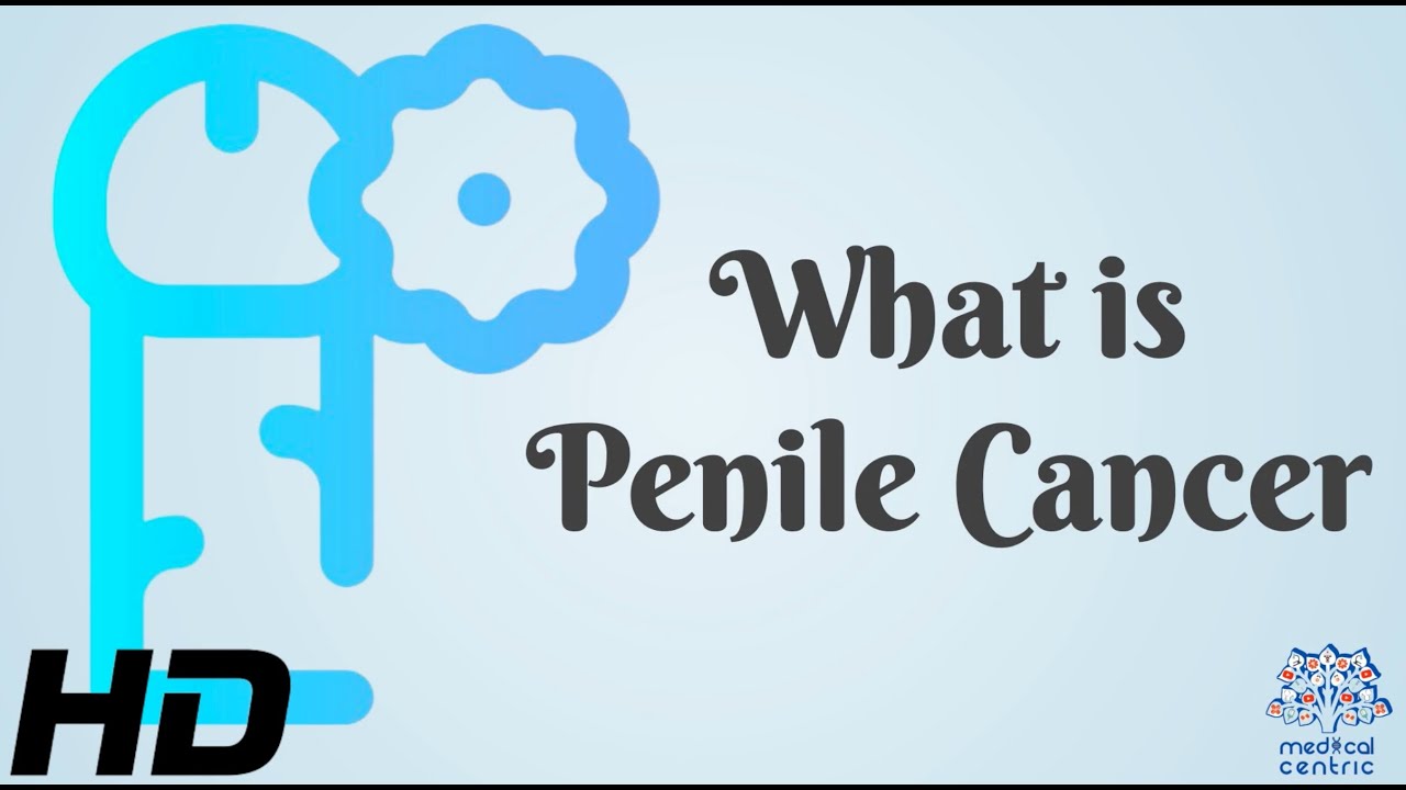 How to treat Pearly Penile Papules? - Dr. Sanjay Panicker