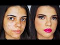 maquiando pele com ACNE -  MAQUIANDO CLIENTE #131 | Nath Freire