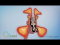 Sinusitis animation