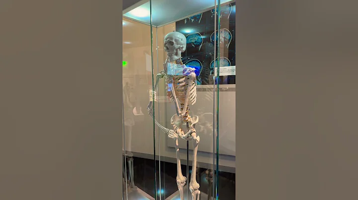 MRI #medical #medicalstudent #nursingstudent #nurse #nursing #nurse #scan #medicine #shorts #brain