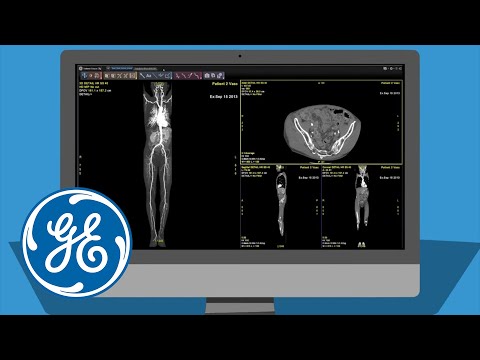 GE Healthcare: AW VolumeShare 7 Advanced Visualisation Software | GE Healthcare