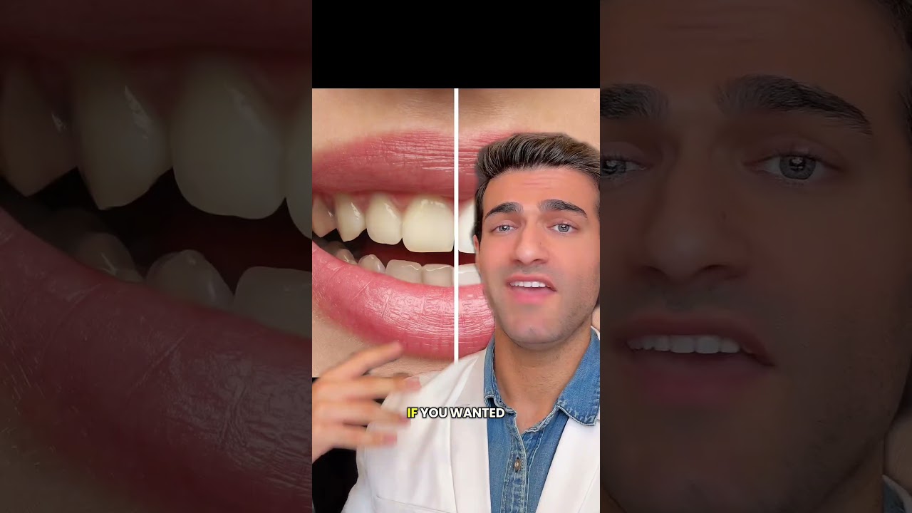 Smile makeover - Here is what you need to know!? 