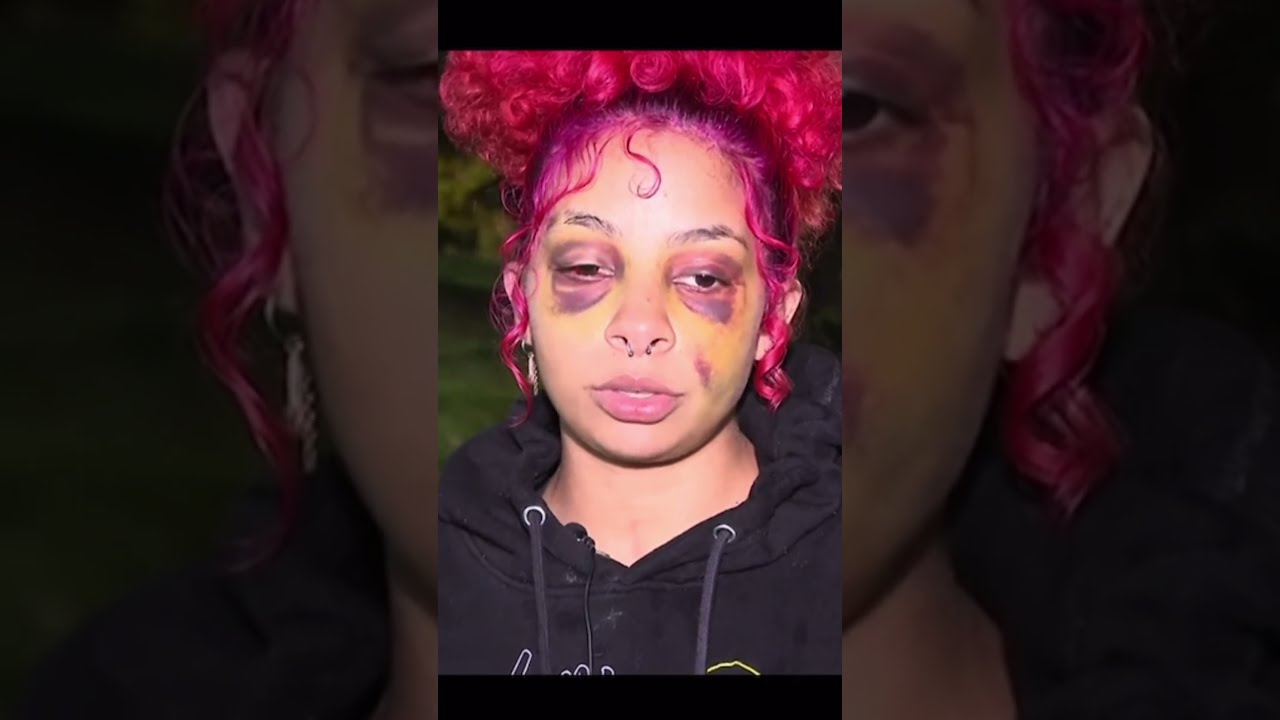 BATTERED BRUISED DOMESTIC VIOLENCE SURVIVOR WARNS OTHERS