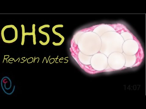 Video: Alt Om OHSS (Ovarian Hyperstimulation Syndrome)