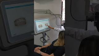 Invisaling Con Scanner Itero - Alineadores Dra Monserrat Navarro