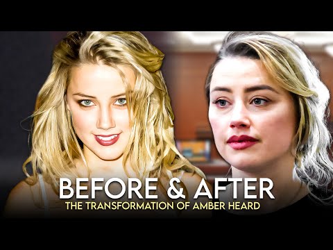 Amber Heard | Before x After | Plastic Surgery Transformation