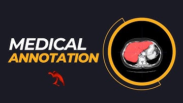 How to Segment CT/MRI scans with ITK-Snap