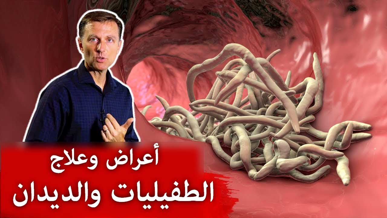 أعراض وجود الطفيليات والديدان بالجسم وأفضل طعام للقضاء عليها!