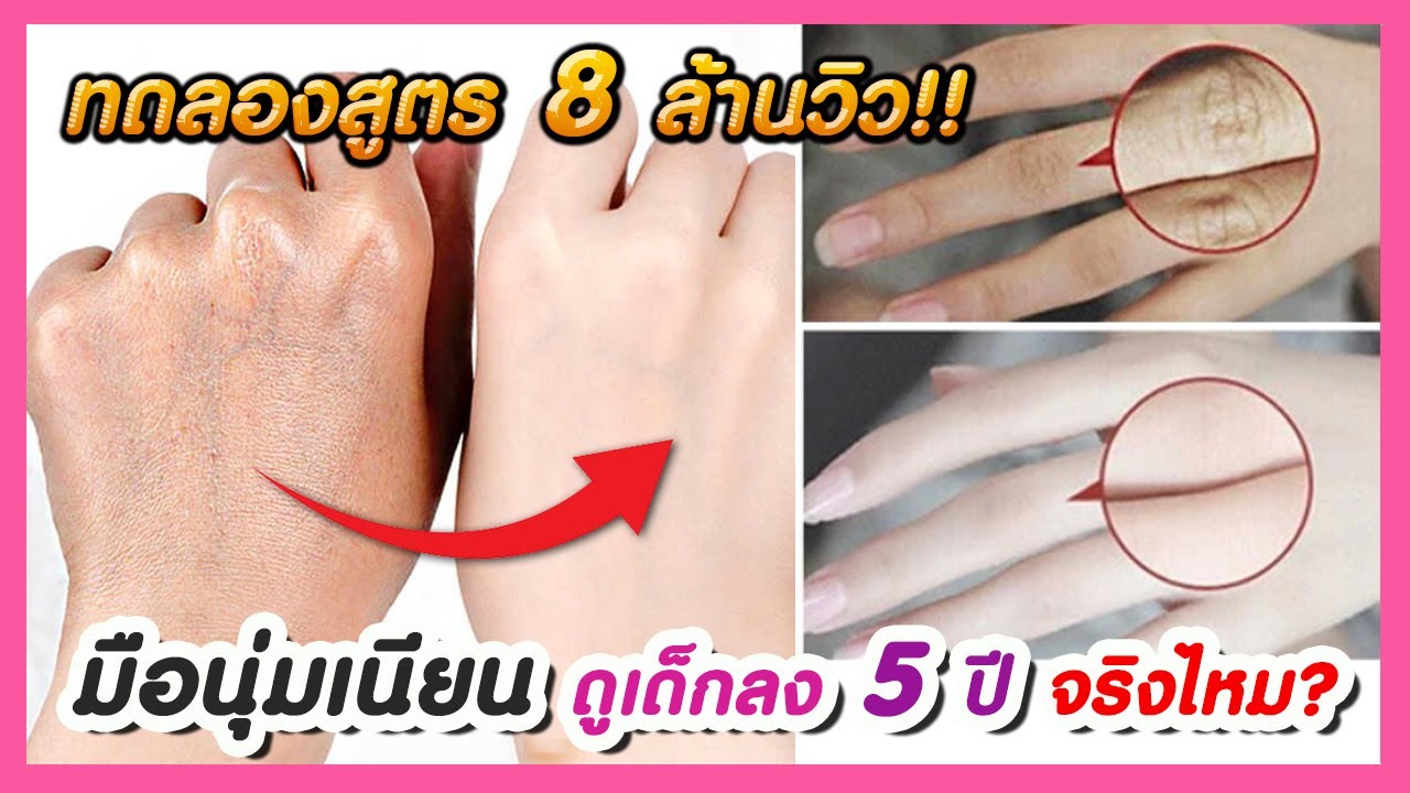 วิธี ทำให้ ผิว เนียน  New Update  มือนุ่มเนียน ดูอ่อนกว่าวัย 5 ปี จริงไหม? (ทดลองสูตร 8 ล้านวิว) แก้มือเหี่ยว มือย่น ให้นุ่มลื่น