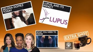 Understanding lupus, its impact and treatment