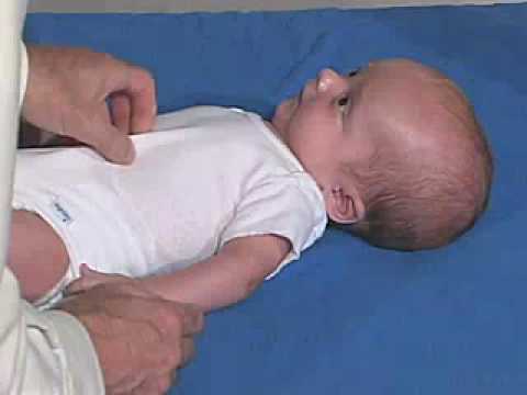 in fisting infant Neuro and exam