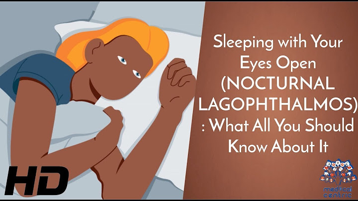 A Blinkless Slumber: Unraveling the Phenomenon of Sleeping with Eyes Open