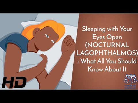 Wideo: Czym są śpiące mrugnięcia?