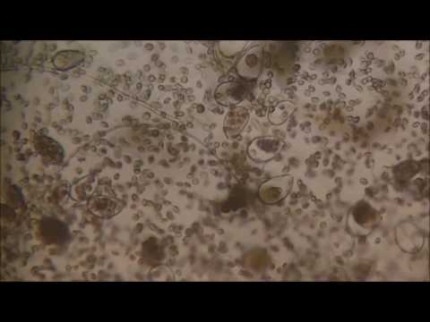 Inducing Zoospores of Phytophthora