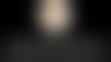 Robotic assisted (SSi Mantra 3)  Right Sided Partial Nephrectomy