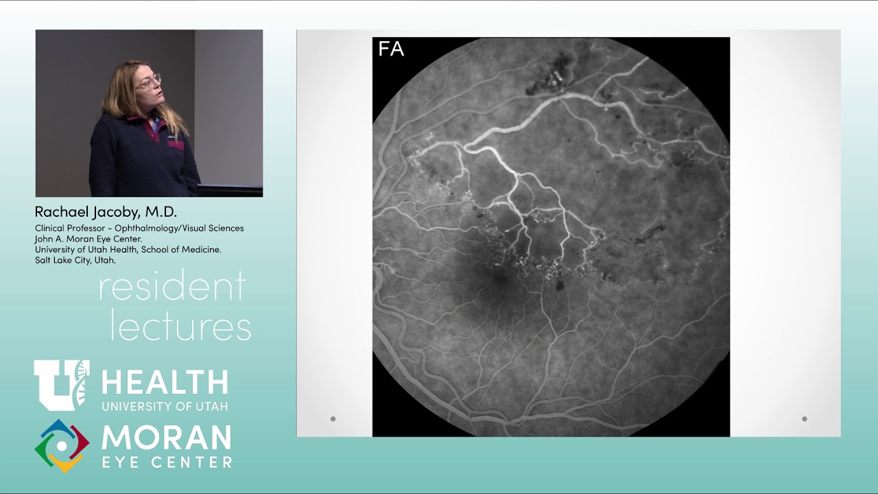 Retinal Vascular Disease: Part 1 of 2 [ARCHIVE] - YouTube
