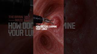 How Doctors Examine Your Lungs