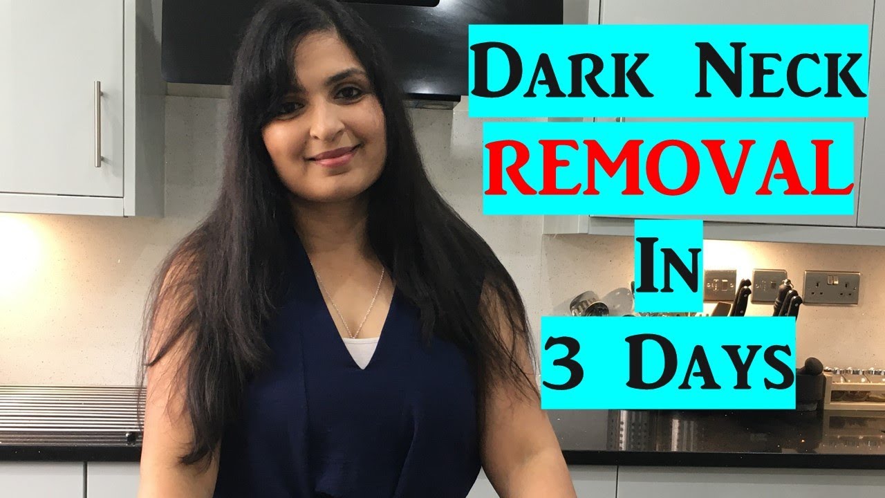 கழுத்தில் உள்ள கருமையை நீக்க/ Best Home Remedy/ Get Rid of Dark Neck -Tamil/ Chennai Girl In