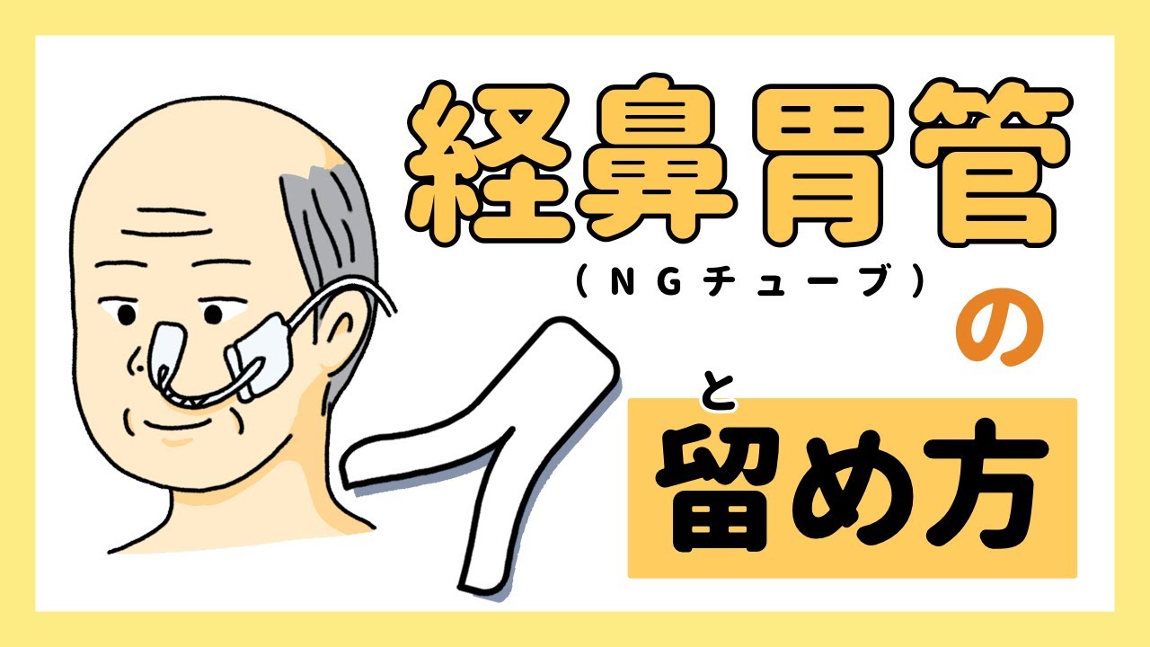 その固定、大丈夫？“抜けた・かぶれた”を防ぐ経鼻胃管固定の基本と工夫 