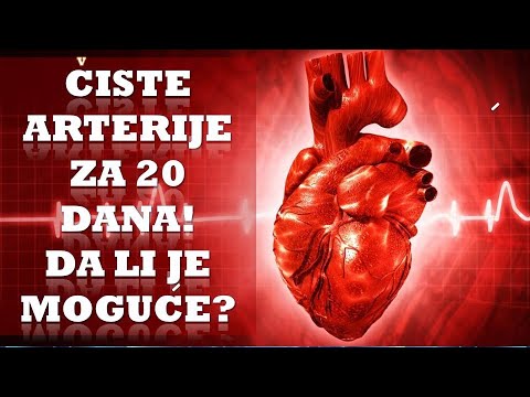 Video: 3 načina za prepoznavanje simptoma začepljenih arterija