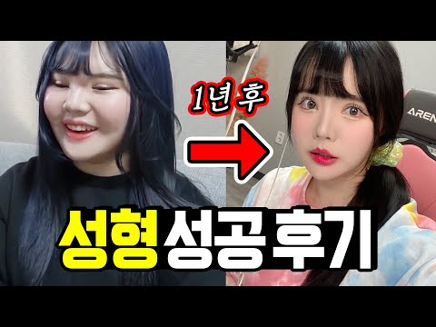 나보고 성형 망했다고 누가 그래? [띠미]