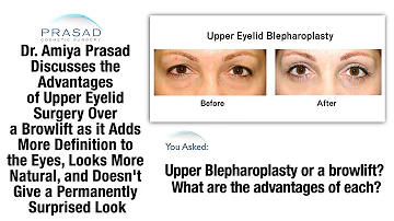 Brow Lift or Blepharoplasty - Why Upper Eyelid Surgery Results in a More Natural and Defined Look