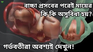 বাচ্চা প্রসবের পরে কি কি হয়|| প্রসবের পরবর্তী সতর্কতা|| প্রসবের পর মায়ের যে অসুবিধা গুলো হয় দেখুন