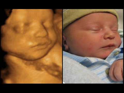 Angel Prints Ultrasound 3D/4D Ultrasounds Lafayette & Baton Rouge, Louisiana